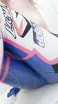 Alinorac   DVa