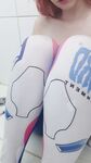 Alinorac   DVa